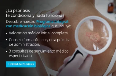 Psoriasis