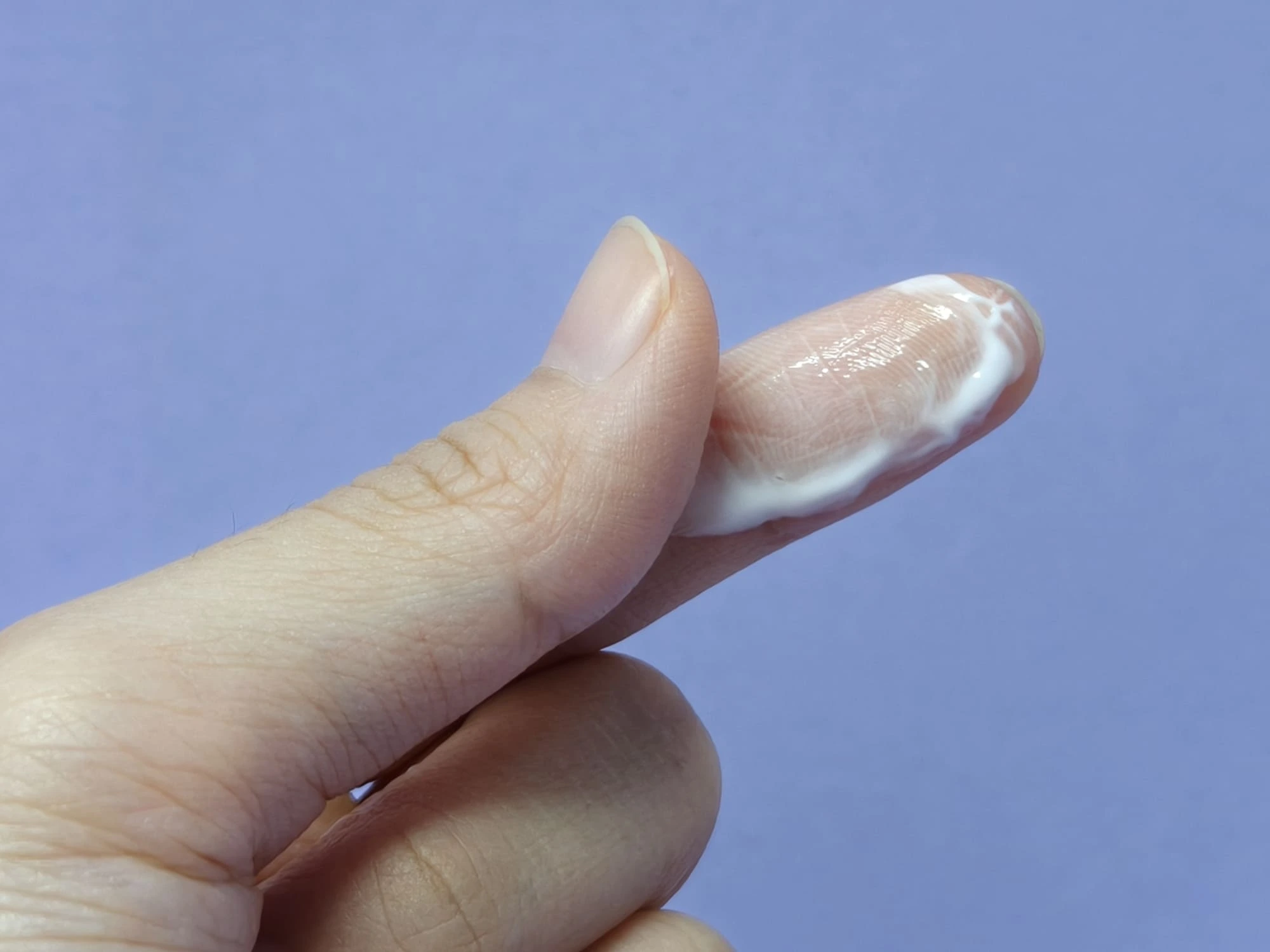 Primer plano de una muestra de flujo vaginal espeso y blanquecino, representando el moco cervical que actúa como barrera protectora para el útero en las primeras semanas de gestación.