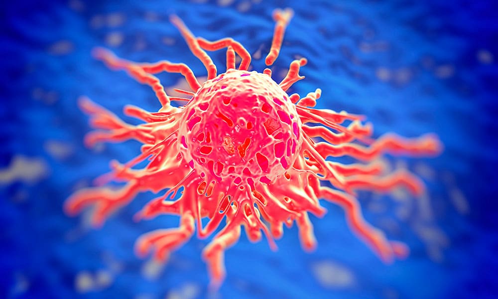 Virus del papiloma humano: El 75% de la población está infectada de VPH tipo mucoso