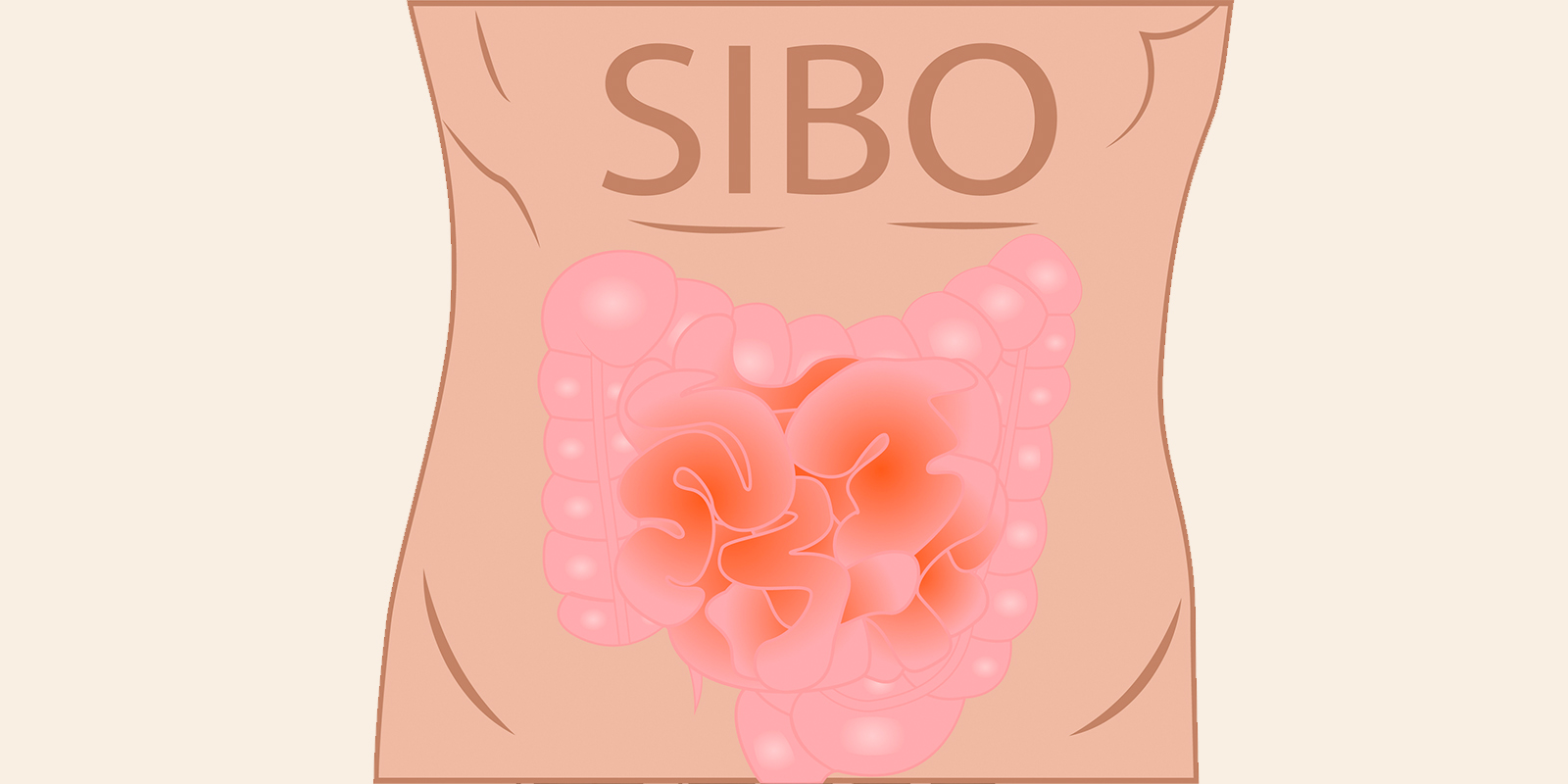 El SIBO: Causa principal de diversas enfermedades