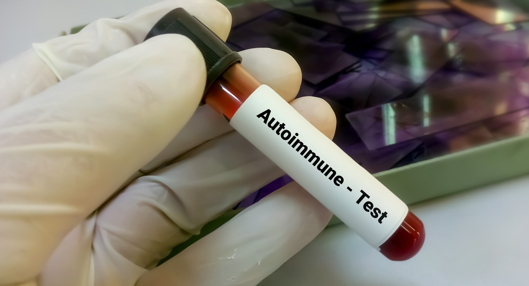 ¿Qué es una enfermedad autoinmune?