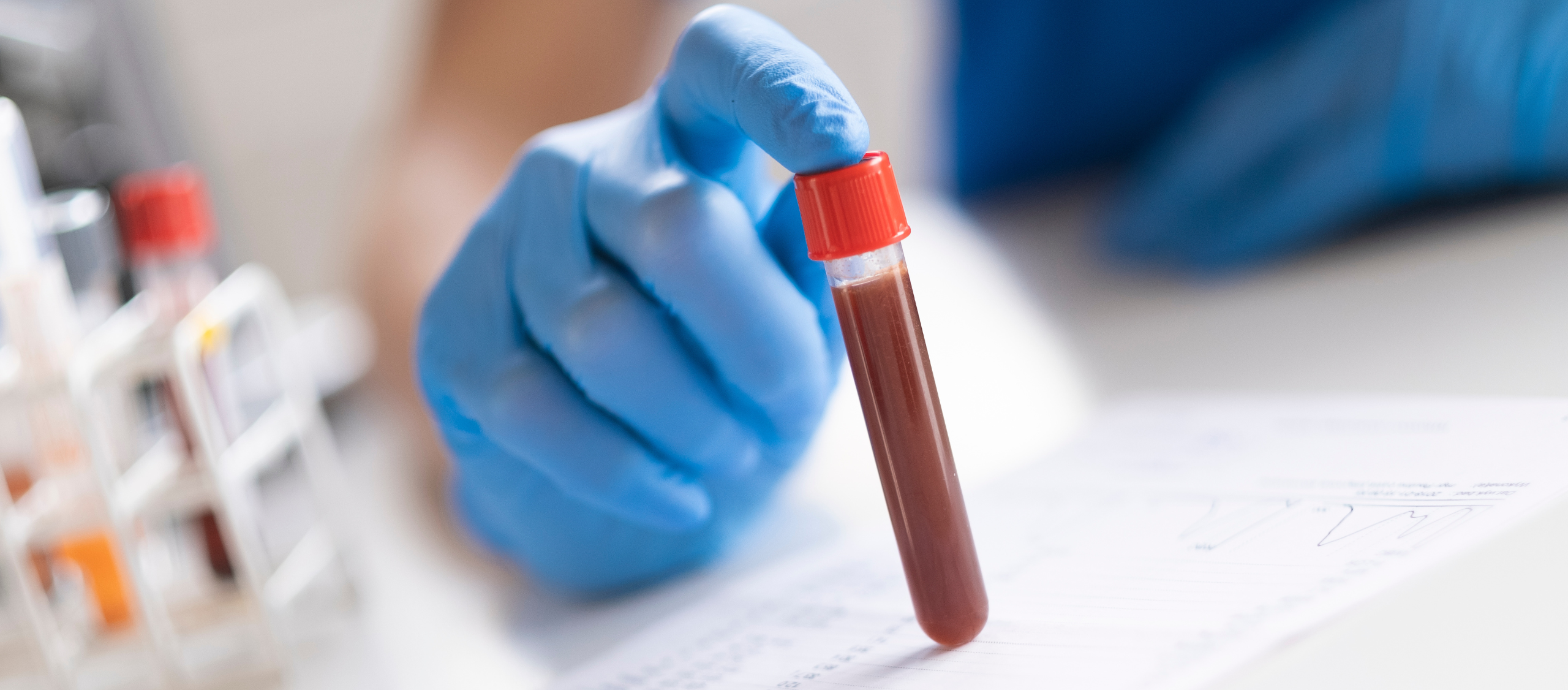 ¿Qué es el HCM en los Análisis de Sangre?
