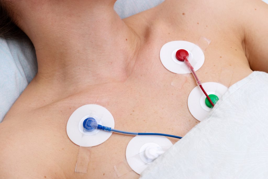 Mujer realizándose prueba de Holter cardiaco.