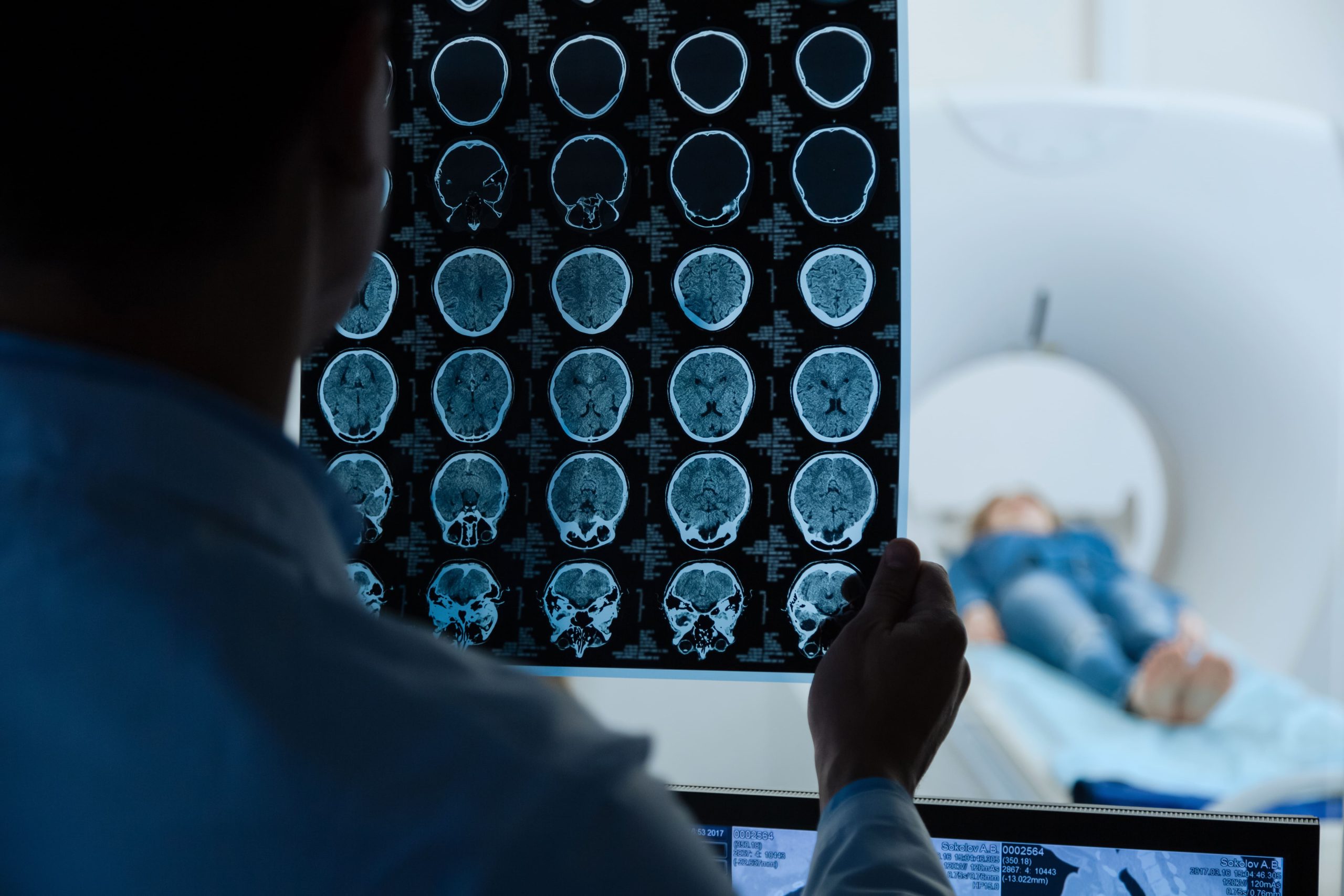 Radiofrecuencia en neurocirugía. ¿Qué beneficios tiene?