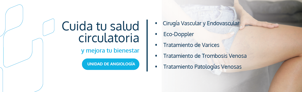 Angiología y Cirugía Vascular